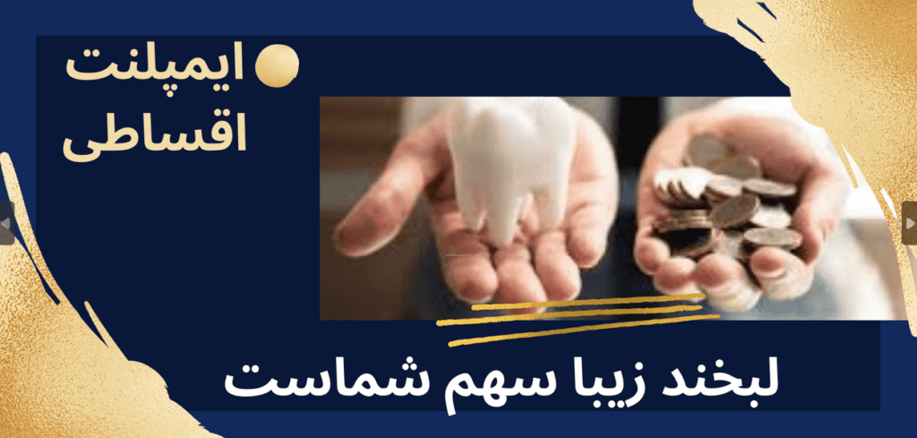 ایمپلنت اقساطی در تهران-کلینیک شیان