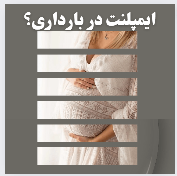 ایمپلنت در بارداری