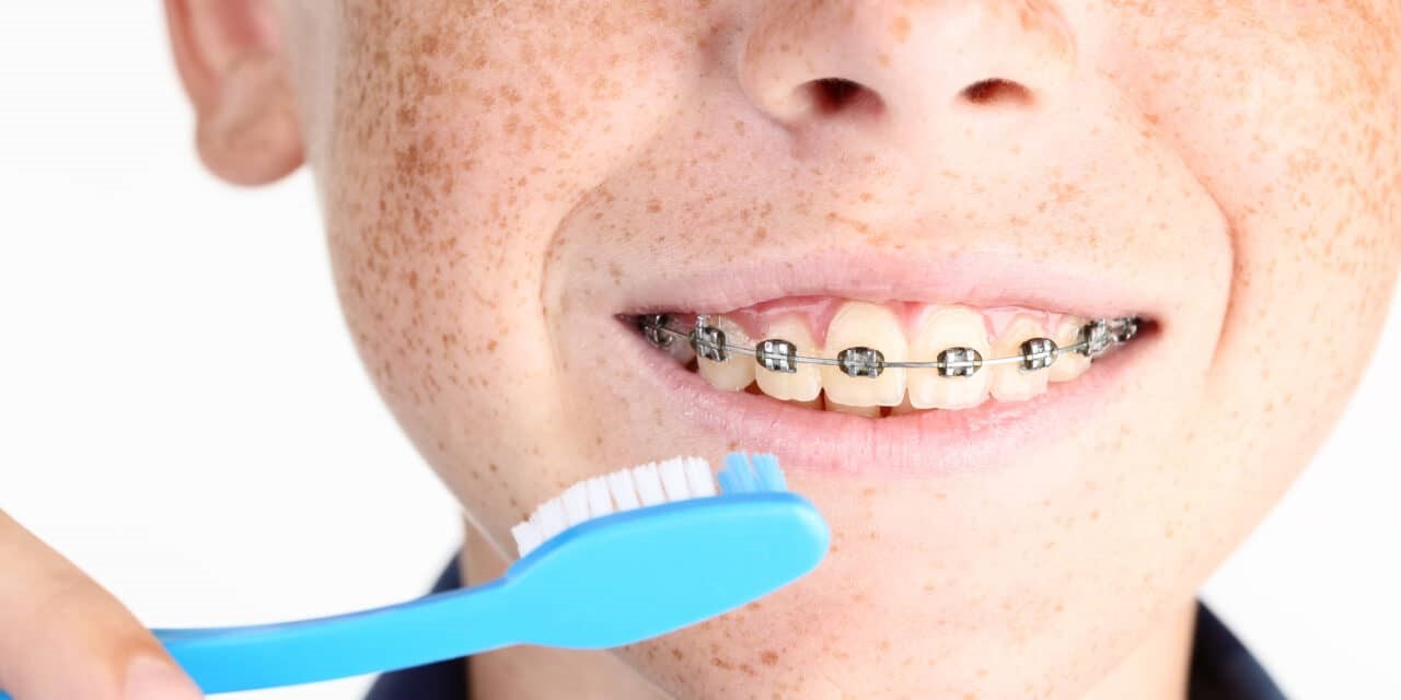 ارتودنسی دندان و لق شدن دندان