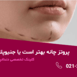 جنیو پلاستی