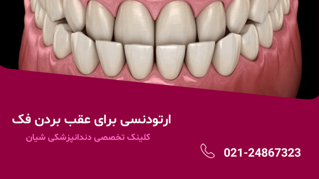 ارتودنسی برای عقب بردن فک