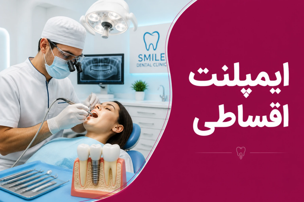 ایمپلنت اقساطی