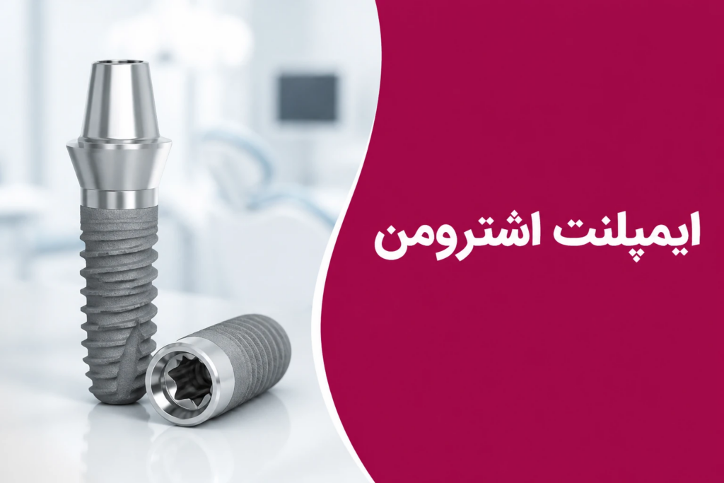 ایمپلنت اشترومن