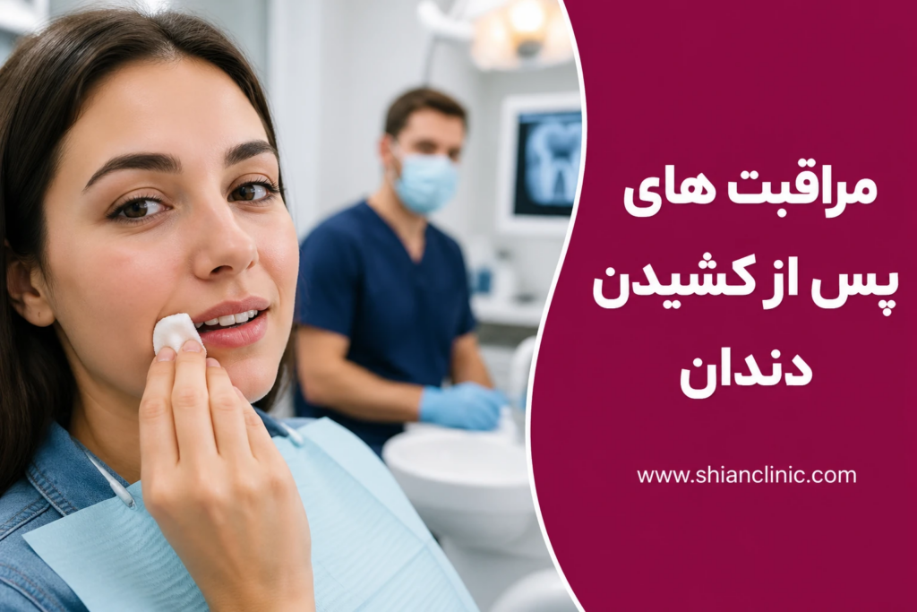 مراقبت های پس از کشیدن دندان