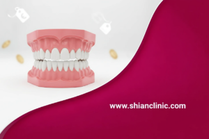 قیمت دندان مصنوعی
