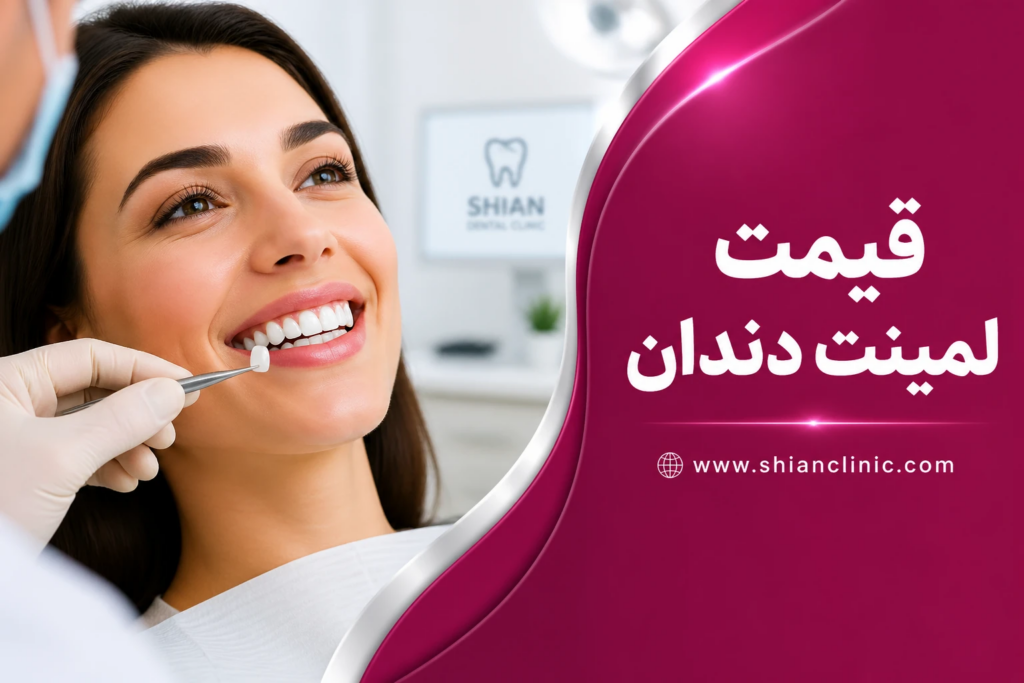 قیمت لمینت دندان