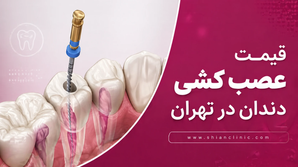 قیمت عصب کشی دندان