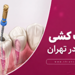 قیمت عصب کشی دندان
