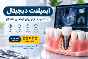 ایمپلنت دیجیتال